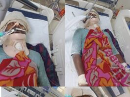 पुताई का काम करने गया युवक जिंदगी और मौत से जूझ रहा: जमींदार पर साजिश का शक, पिता बोले– धमकियां मिल रही हैं; पुलिस ने अब तक नहीं लिखी एफआईआर