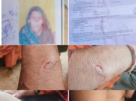 नाबालिग लड़कियों को भगाकर जबरन सगाई कराने का आरोप, विरोध करने पर परिवार पर चाकू और पत्थरों से हमला; पीड़ितों ने लगाई न्याय की गुहार